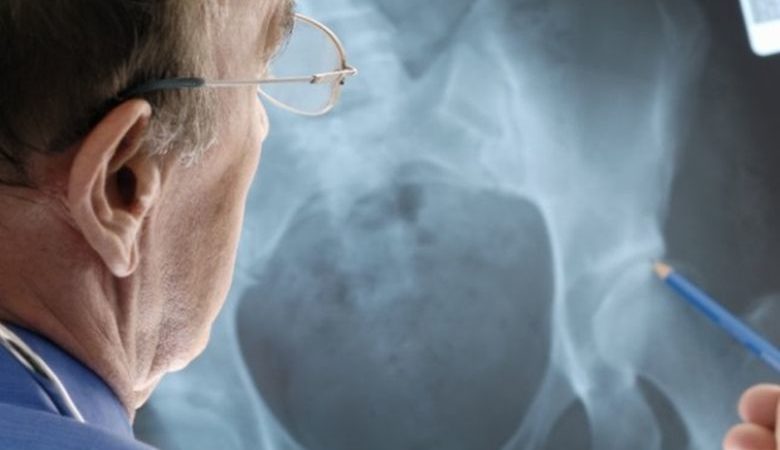 Η ρύπανση του αέρα αυξάνει τον κίνδυνο οστεοπόρωσης στους ηλικιωμένους