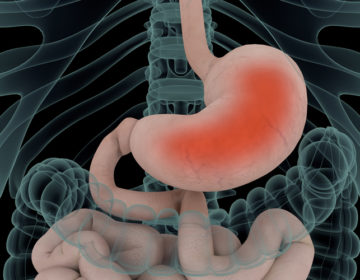 Τι ενεργοποιεί την καούρα και τη δυσπεψία και πώς αντιμετωπίζονται