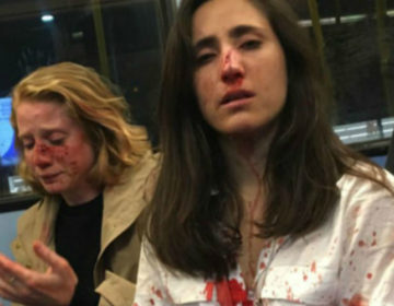 Τέσσερις συλλήψεις για την σοκαριστική ομοφοβική επίθεση εναντίον δυο γυναικών στο Λονδίνο