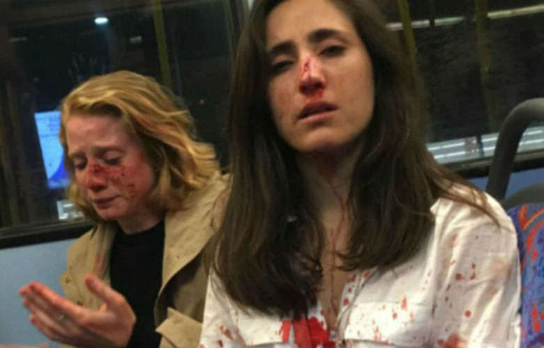 Τέσσερις συλλήψεις για την σοκαριστική ομοφοβική επίθεση εναντίον δυο γυναικών στο Λονδίνο