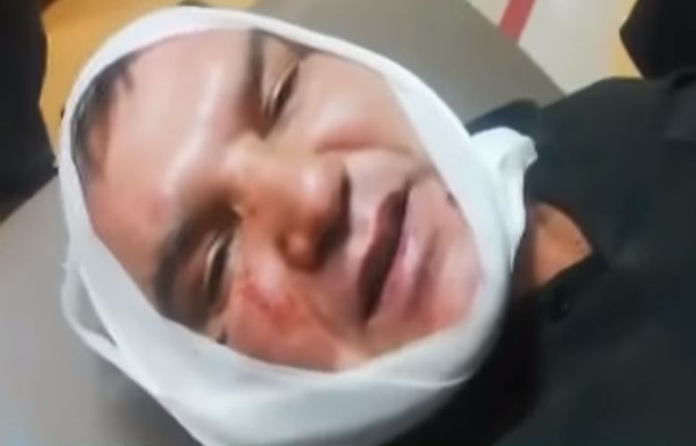 Δάγκωσαν και έκοψαν το αυτί παραγωγού σε λαϊκή αγορά