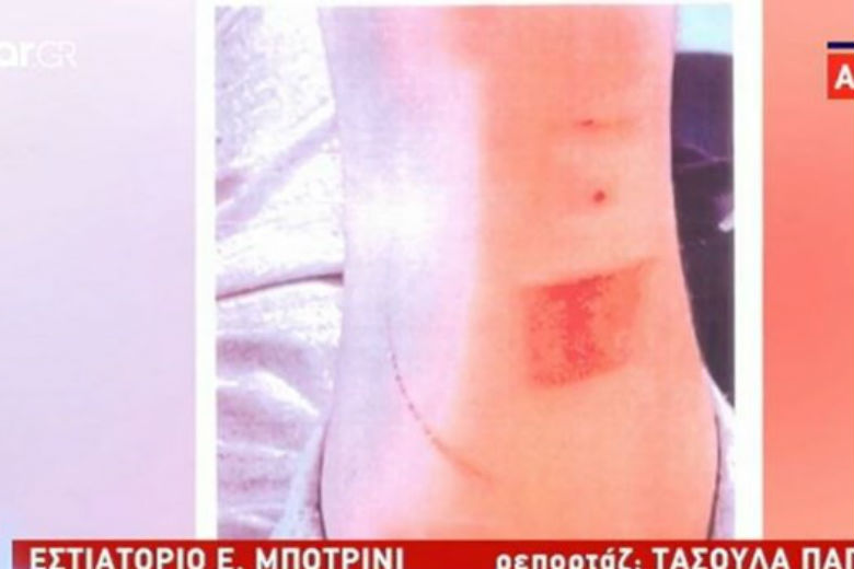 Εισαγγελική έρευνα για τις καταγγελίες του 19χρονου σπουδαστή στο εστιατόριο του Μποτρίνι