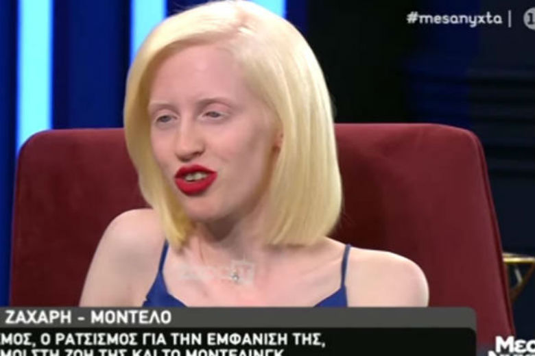 Μοντέλο με αλφισμό: Μητέρα δεν άφησε το παιδί της να κάτσει δίπλα μου για να μην κολλήσει