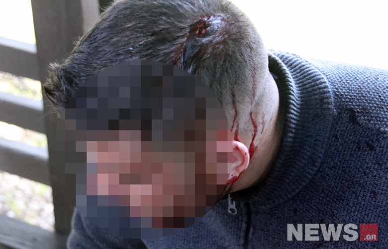 Συμπλοκή φοιτητών – ΜΑΤ στο Καβούρι: Φοιτητής τραυματίστηκε στο κεφάλι