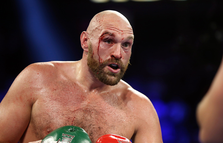 Tyson Fury: Κάνω πολύ στοματικό έρωτα για να έχω δυνατό σαγόνι