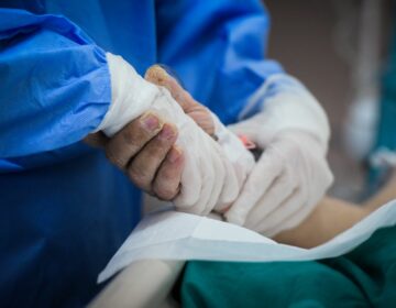 Θετική εξέλιξη για τον 19χρονο φοιτητή με τη μηνιγγίτιδα: Αποσωληνώθηκε και έχει επικοινωνία με το περιβάλλον