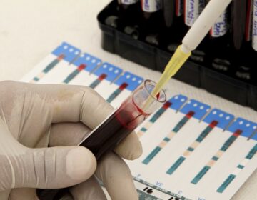 Ευθύνες σε διαδοχικές κυβερνήσεις επιρρίπτει η έρευνα για το σκάνδαλο του μολυσμένου αίματος στην Βρετανία