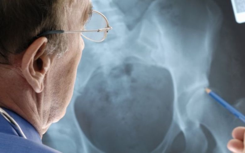 Η ρύπανση του αέρα αυξάνει τον κίνδυνο οστεοπόρωσης στους ηλικιωμένους