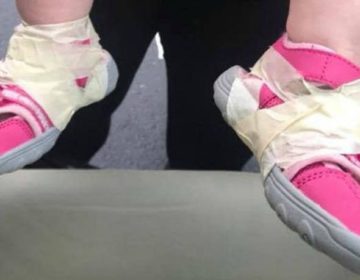 Υπάλληλος παιδικού σταθμού έδεσε με ταινία τα παπούτσια στα πόδια μωρού