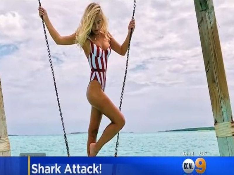 Μοντέλο έβγαζε φωτογραφία και της επιτέθηκε καρχαρίας
