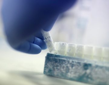 Τι ανακάλυψαν οι επιστήμονες για την διατήρηση του σπέρματος στο διάστημα