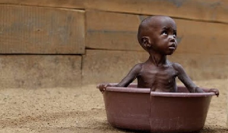 Τα παιδιά συνεχίζουν να πεθαίνουν από την πείνα στην Αφρική