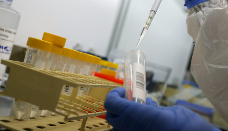 Βρετανία: Λουκέτο σε εργαστήριο – Έδωσε λάθος αποτελέσματα σε πάνω από 40.000 τεστ κορονοϊού
