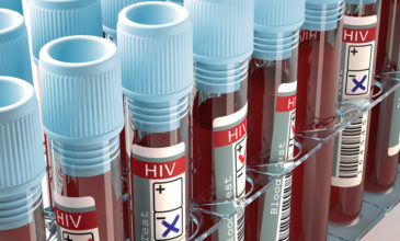 Αυξητική τάση του ιού HIV σε άτομα ηλικίας 50-64 ετών