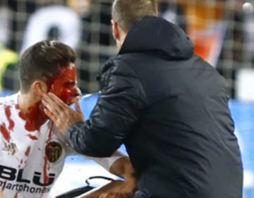 Γροθιές και αίμα στο Copa del Rey