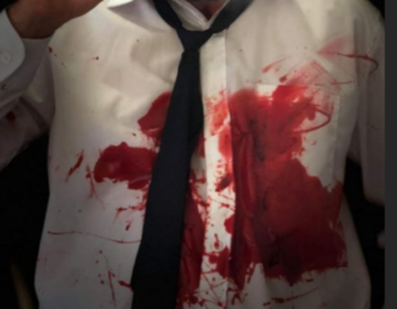 Η ματωμένη φωτογραφία του «δολοφονημένου» ηθοποιού του Τατουάζ