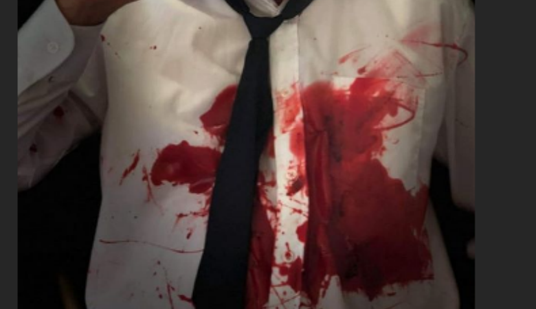 Η ματωμένη φωτογραφία του «δολοφονημένου» ηθοποιού του Τατουάζ