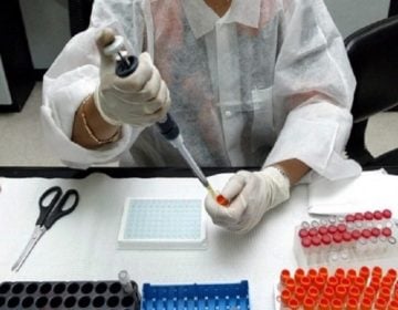 Πειραματικό εμβόλιο κατά του AIDS σε ΗΠΑ και Ευρώπη