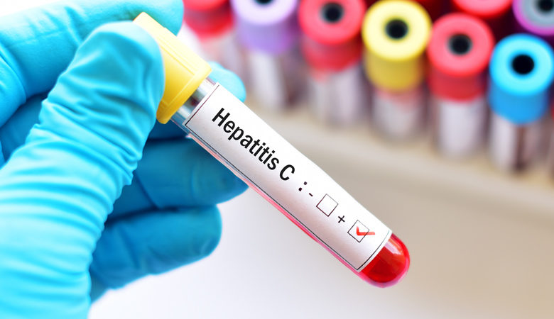 Περίπου 75.000 Έλληνες αγνοούν ότι πάσχουν από ηπατίτιδα C