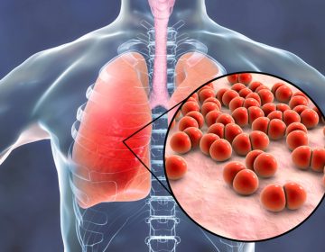 Τι είναι η πνευμονιοκοκκική νόσος και πόσο απειλεί την υγεία μας