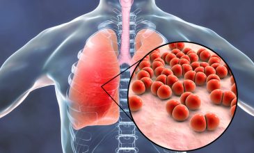 Τι είναι η πνευμονιοκοκκική νόσος και πόσο απειλεί την υγεία μας