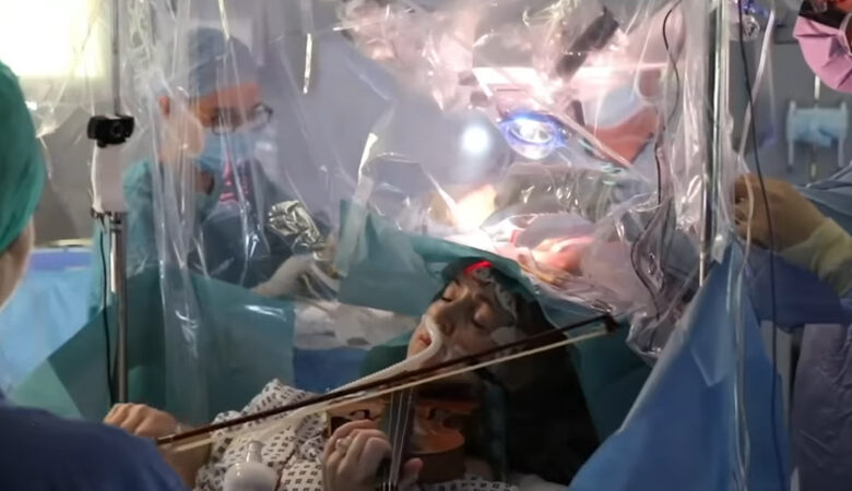 Ασθενής έπαιζε βιολί τη στιγμή της εγχείρησης στον εγκέφαλό της