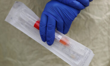 Κορονοϊός: Αυτά είναι τα νέα τεστ που θα πέσουν στη μάχη κατά του ιού