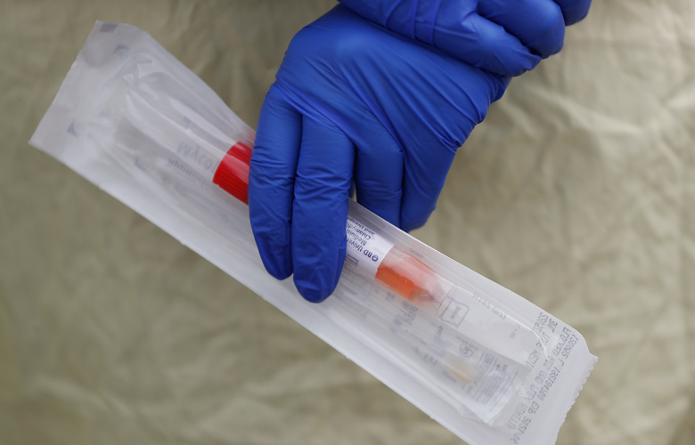 Κοροναϊός: Αυτά είναι τα νέα τεστ που θα πέσουν στη μάχη κατά του ιού