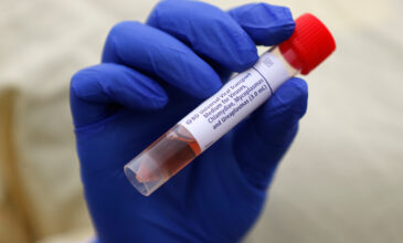 Κορονοϊός: Με ποια ομάδα αίματος κινδυνεύετε περισσότερο να κολλήσετε τον ιό