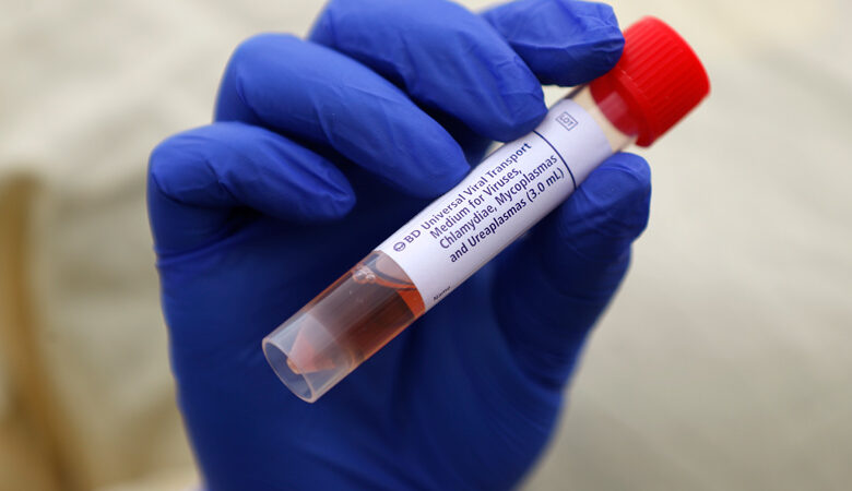 Κορονοϊός: Με ποια ομάδα αίματος κινδυνεύετε περισσότερο να κολλήσετε τον ιό
