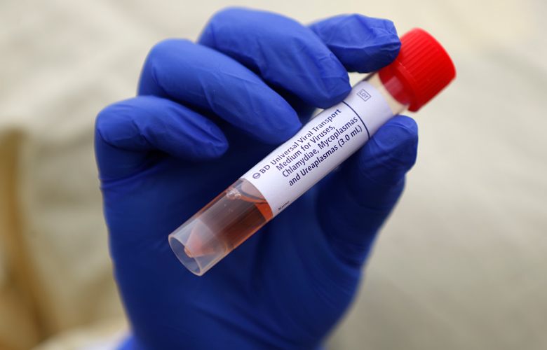 Κοροναϊός: Με ποια ομάδα αίματος κινδυνεύετε περισσότερο να κολλήσετε τον ιό