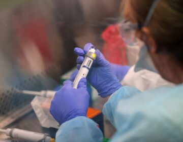 Κορονοϊός: Τι θα καθορίζει την θεραπεία των ασθενών – Πότε θα υπάρξει εμβόλιο