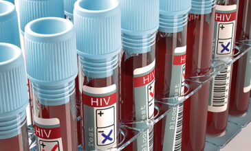 Γκουτέρες: Ο HIV μολύνει 1,7 εκατ. ανθρώπους κάθε χρόνο, ενώ σκοτώνει 690.000