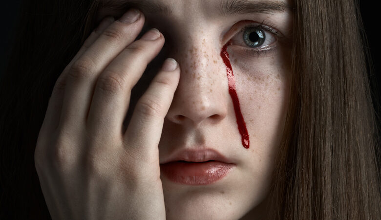25χρονη έχυνε δάκρυα από αίμα στη διάρκεια της περιόδου της