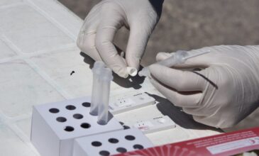 Rapid test: Πώς θα διενεργούνται τα υποχρεωτικά για τους ανεμβολίαστους στον ιδιωτικό τομέα