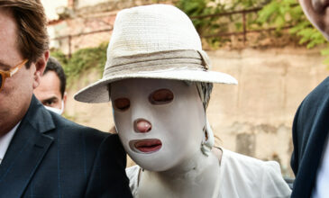 Επίθεση με βιτριόλι: Μέχρι πότε θα φορά την προστατευτική μάσκα η Ιωάννα
