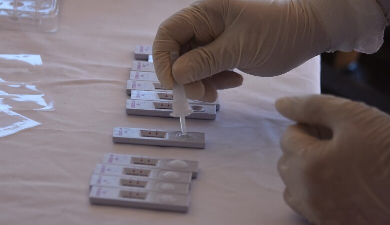 Κορονοϊός: Νέα τιμή στα μοριακά τεστ (PCR) – Πόσο θα κοστίζουν