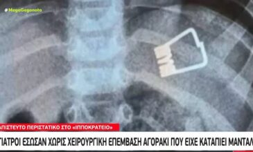 Θεσσαλονίκη: Γιατροί έσωσαν χωρίς χειρουργική επέμβαση αγοράκι που κατάπιε μανταλάκι