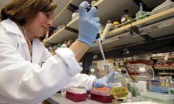 Έλληνες ερευνητές από το ΙΤΕ, το ΕΚΠΑ και το Πανεπιστήμιο Harvard ανακάλυψαν σημαντικά στοιχεία για τα βλαστικά κύτταρα του εντέρου