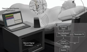 Εμφυτευμένη στον εγκέφαλο συσκευή επέτρεψε την επικοινωνία με παράλυτο ασθενή