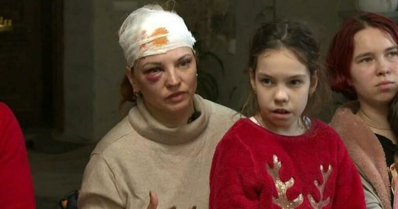 Πόλεμος στην Ουκρανία: Συγκλονιστικές ιστορίες από παιδιά που τραυματίστηκαν στη Μαριούπολη