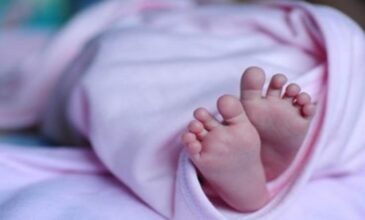 Ινδία: Γεννήθηκε μωρό με δύο κεφάλια, τρία χέρια και δύο καρδιές