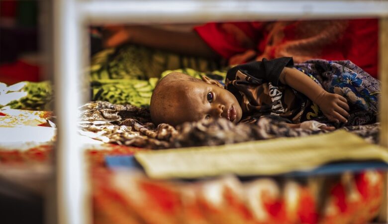 Δύο εκατομμύρια παιδιά κινδυνεύουν να πεθάνουν από πείνα στο Κέρας της Αφρικής