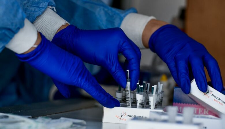 Ευλογιά των πιθήκων – Μαγιορκίνης: «Δεν προβλέπεται εμβολιασμός του γενικού πληθυσμού για την ευλογιά των πιθήκων»