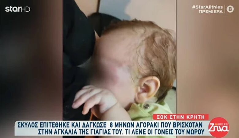 Επίθεση σκύλου σε μωρό – Συγκλονίζει η μητέρα του παιδιού: «Δεν ήξερα εάν είχε μάτι»
