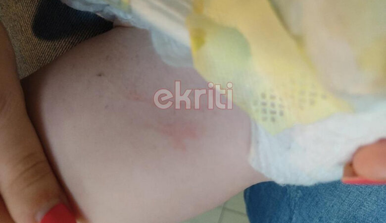 Ηράκλειο: Σοκαριστικές εικόνες από την επίθεση του σκύλου σε μωρό
