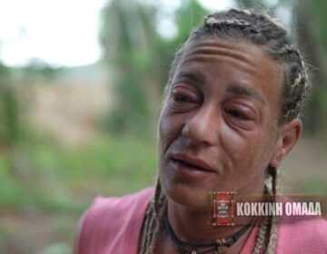 Survivor: Η τρομακτική παραμόρφωση της Αφροδίτης Σκαφίδα – Εσπευσμένα στο νοσοκομείο