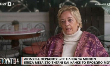 Διονυσία Θεριανού: «Έπεσα μέσα στο τηγάνι και κάηκε το πρόσωπο μου – Με φώναζαν τέρας και Κουασιμόδο»