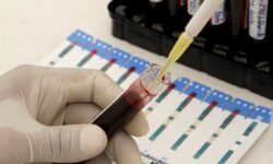 Ευθύνες σε διαδοχικές κυβερνήσεις επιρρίπτει η έρευνα για το σκάνδαλο του μολυσμένου αίματος στην Βρετανία
