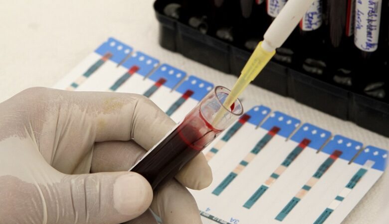 Κορονοϊός: Ποια ομάδα αίματος «προτιμά» ο ιός – Ποιοι είναι πιο ευάλωτοι